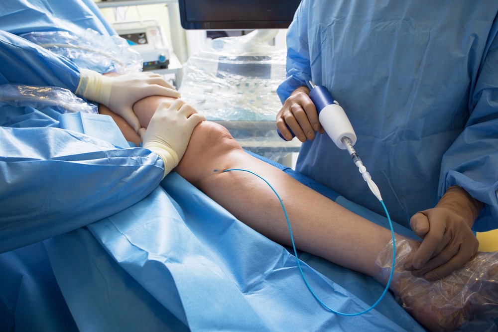 Cirugía Vascular