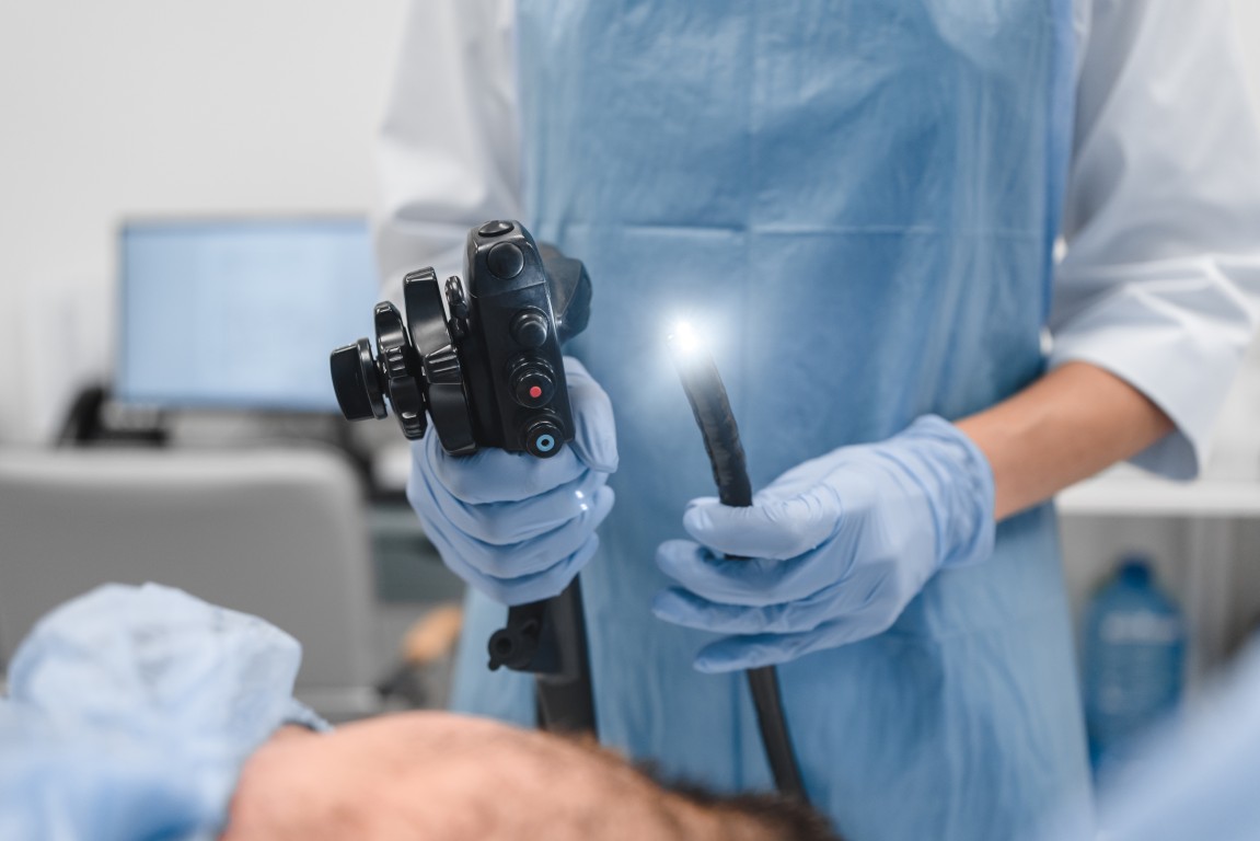 Endoscopia
